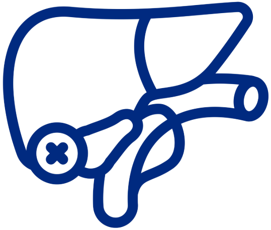 Icono Colecistectomía